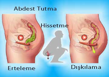 defekografi, dışkılama, abdest tutma Anorektal Fonksiyonlar