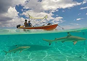 defekografi nasıl yapılır